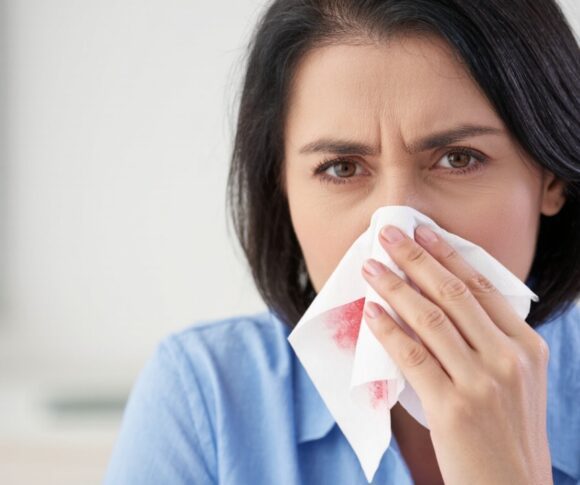 Nosebleeds: When to See a Doctor? 🚨 Essential Guide Inside