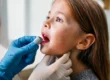 Tonsillitis & Adenoid Surgery: When Is It Necessary? 🤔🔍