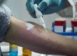 🩺 Allergy Testing Explained: Pinpoint Your Triggers Today!
