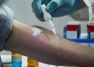 🩺 Allergy Testing Explained: Pinpoint Your Triggers Today!