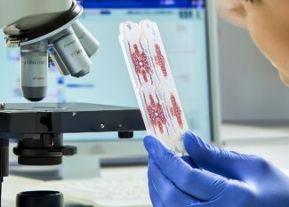 🩺 Cytological Examination Explained: Simple Test, Big Insights!