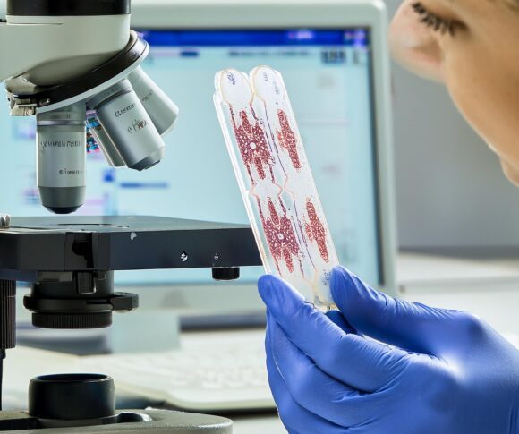 🩺 Cytological Examination Explained: Simple Test, Big Insights!