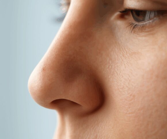 Nasal Polyps Treatment Guide: Breathe Easy Again | ENT Tips